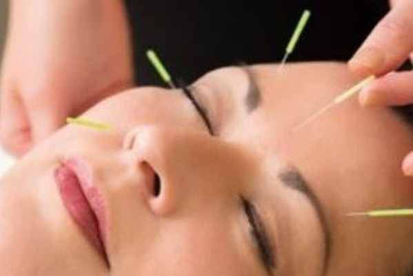 Anti aging acupunctuur